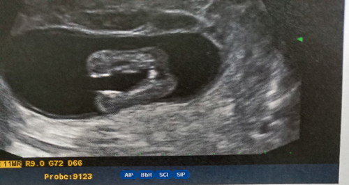 ซาวดูเมื่อวาน16wไม่แน่ใจว่าเพศอะไร