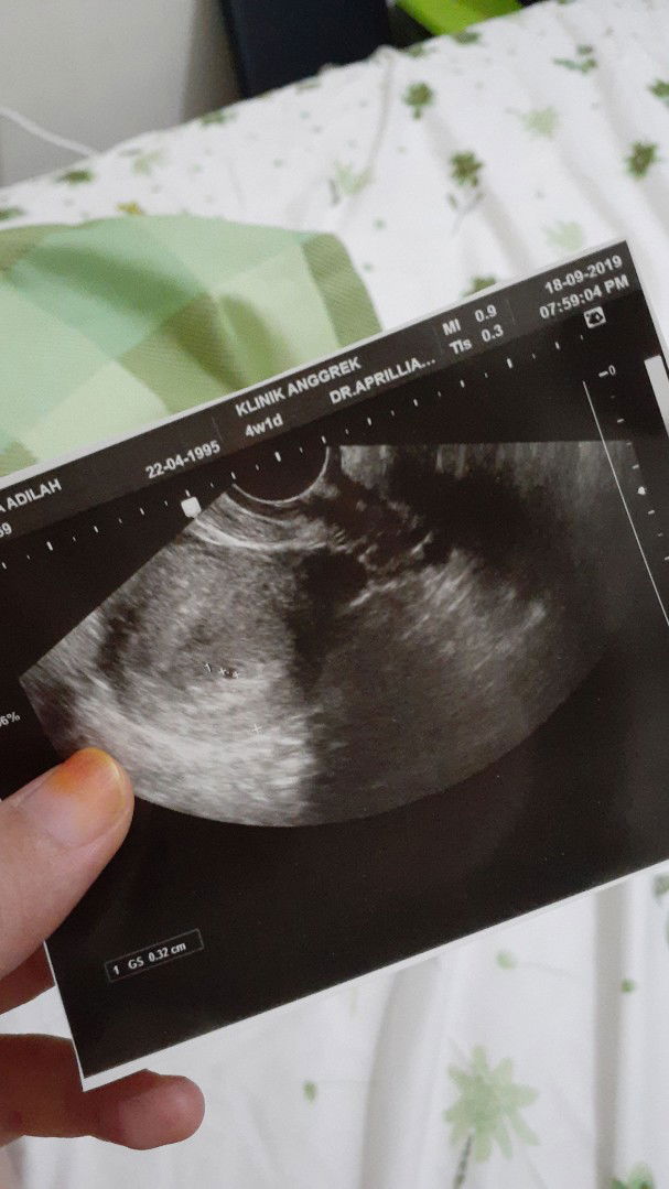 Hamil 4w mual menggantung