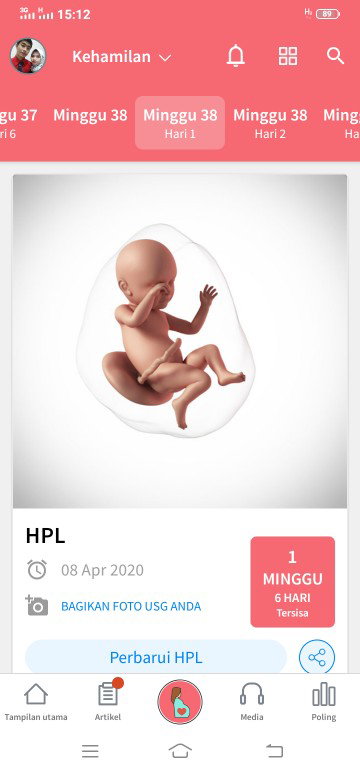 hpl