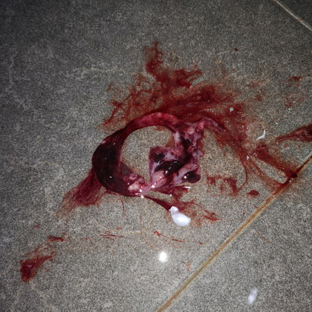 Keguguran Atau Period Biasa? New UPDATE ?