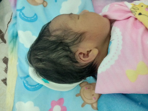 กังวลเรื่อง หัวของลูกค่ะ ช่วยแชร์ประสบการณ์ด้วยค่ะ