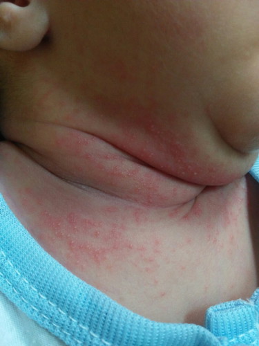 ลูกเป็นแบบนี้