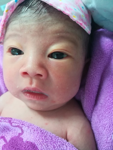 จีซิกพีดี สาเหตุที่น้องตัวเหลือง