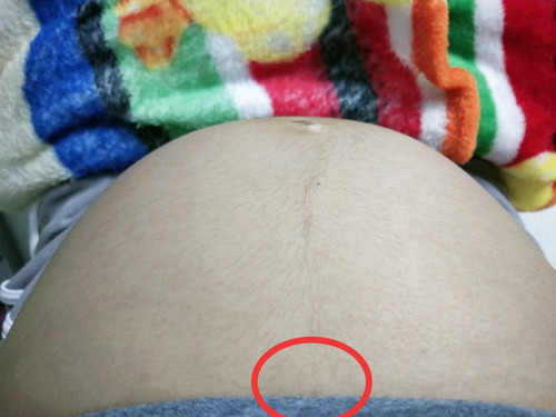 เจ็บจี๊ดๆ