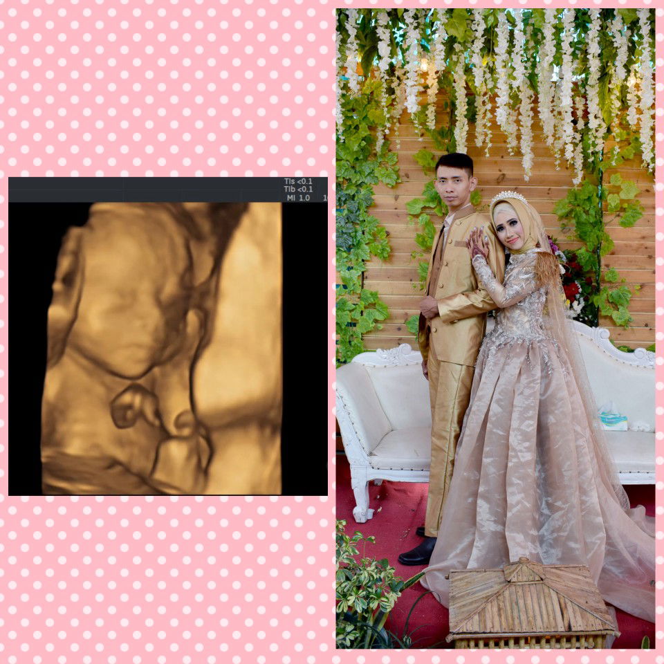 Melly Agustine profile icon