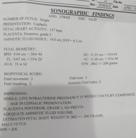 magulong mga midwife