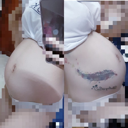 แม่บ้านนี้ท้องแรกจ้าท้องออกตอน 4 เดือนแต่เริ่มรู้สึกลูกตอดตอน 3 เดือนตอนนี้ 5 เดือนดิ้นแรงดิ้นบ่อยมาก แม่ๆๆบ้านไหนท้องออกตอน 4 เดือนบ้างจ้าแบบว่าเริ่มมีคนทักแม่ๆกันตอนกี่เดือนจ้าลูกเริ่มดิ้นกันตอนกี่เดือนจ้าแม่ๆ