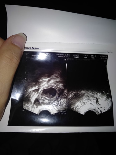 แบบนี้น้องมีโอกาสหยุดการเจริญเติบโตไหมค่ะ