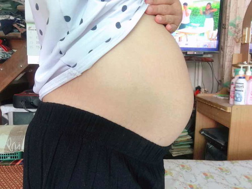 18 W 5 D