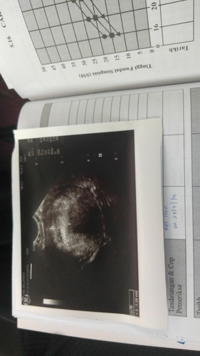 scan 4weeks