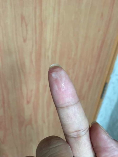 ข้อแตกต่างระหว่าง มูกกับตกขาว