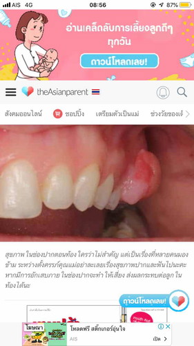 เหงือกบวม?