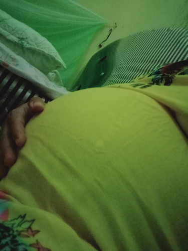 sering kontraksi palsu 31 week ??