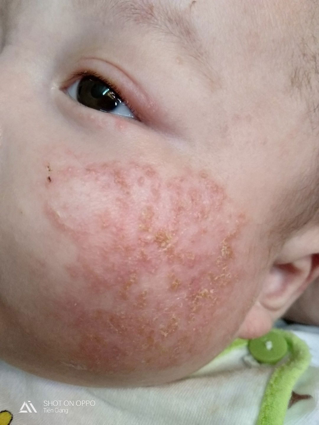 thắc mắc về bé