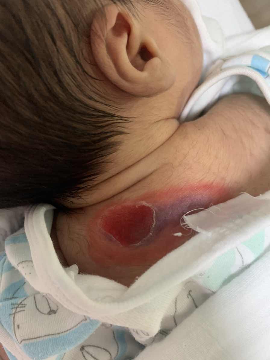 เผื่อในกลุ่มจะมีคุณหมอคะ หรือใครทราบบ้างว่าเป็นเพราะอะไร??