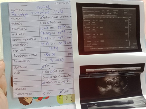 สอบถามค่ะน้ำหนักน้องตามเกณไหมคะ