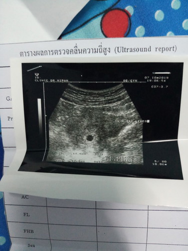 ขอคำแนะนำ