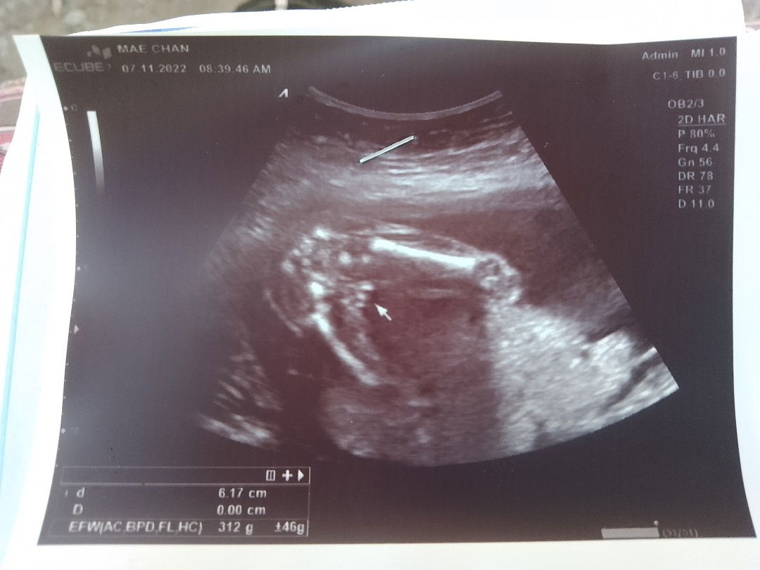 แบบนี้เพศจะชัดพอหรือยังค่ะ