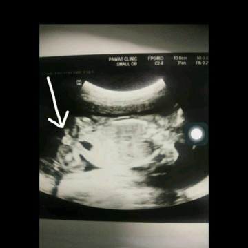 แม่บ้านไหนมองออก บ้าง ?