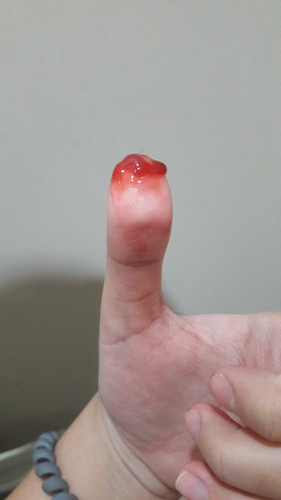 อยากได้ความรู้จากคุณแม่ต่างบ้าน