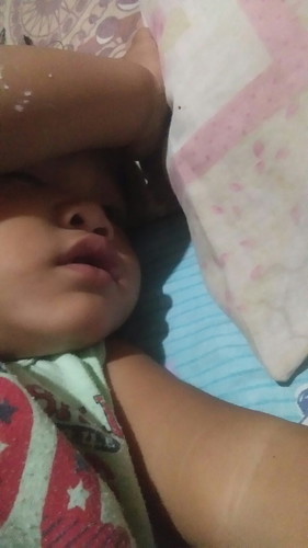 ano po ba gamot sa hika