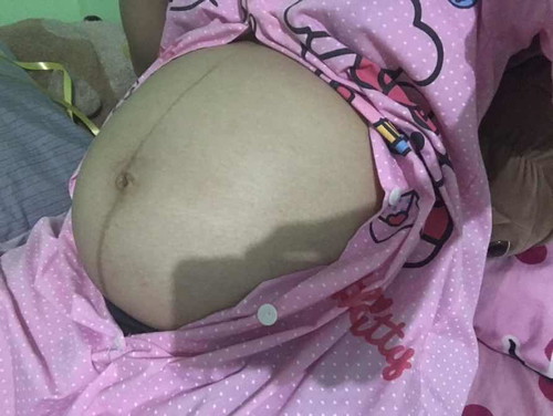 คนท้องคุยกัน