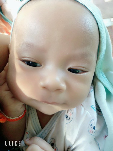ลูกน้อยมีอาการไข้กับขี้มูกตันจมูกทำไงดีค่ะลูกพึ้งได้3เดือน