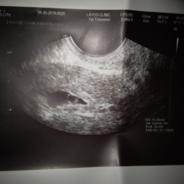 5weeks
