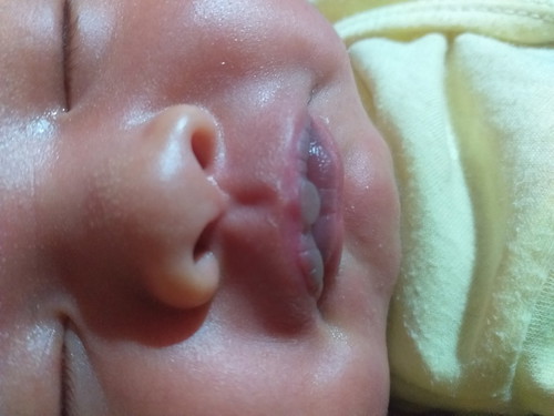 lips