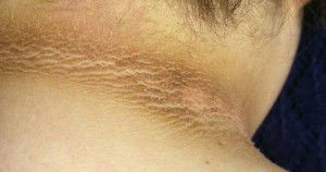 Bintik2 hitam dibadan