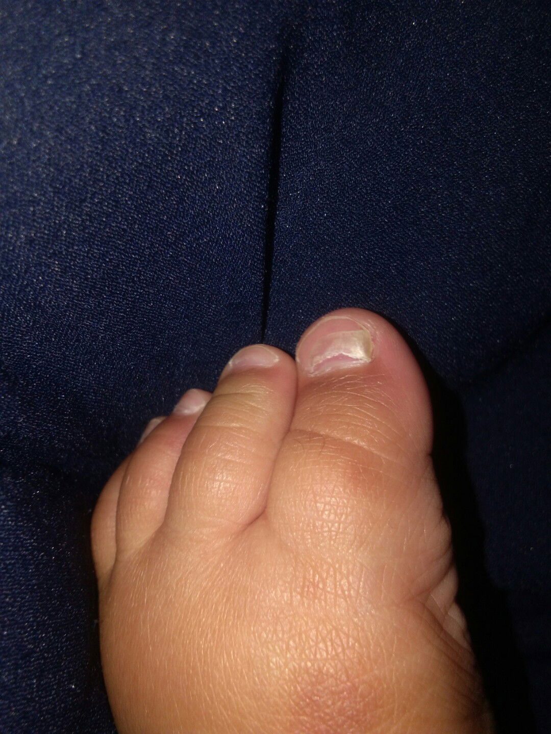 baby nail