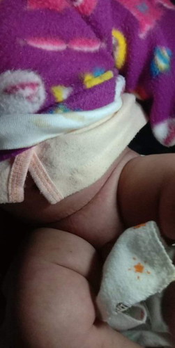 เป็นอย่างนี้เป็นไรคะ