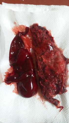 จากของขวัญ..กลายเปน(แท้ง)ความเศร้าที่แสนเจ็บปวด