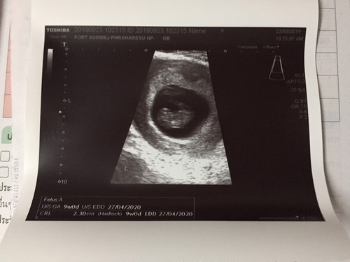 เพิ่งโหลดแอพมา??ลองเล่นดู