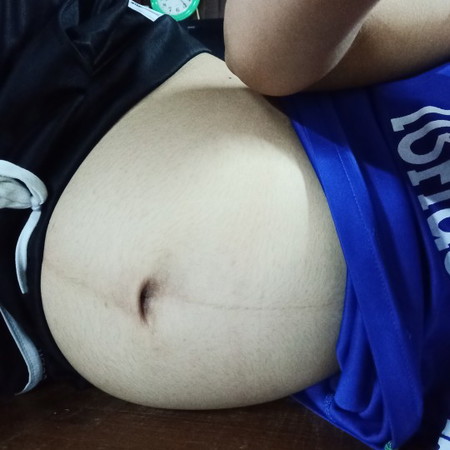 เพศลูก
