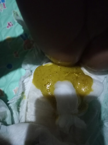 Poop