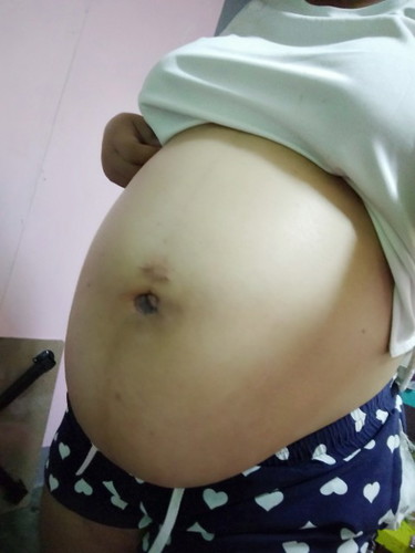 38 สัปดาห์ ท้องลดต่ำ ปวดเชิงกรานมากค่ะ