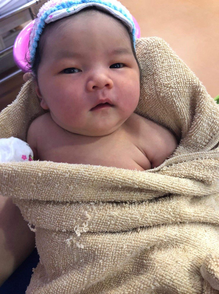 ผ่าคลอด