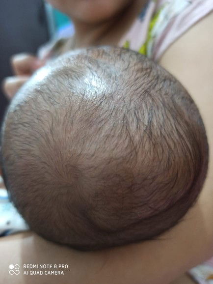 cairan d kepala bayi