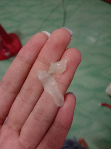 ตกขาวหรืออะไรค่ะ