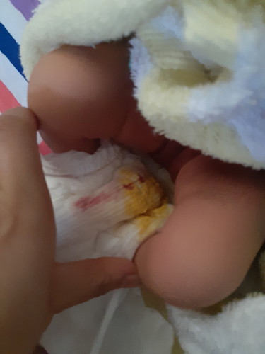 ขออนุญาติสอบถามแม่ๆค่ะ