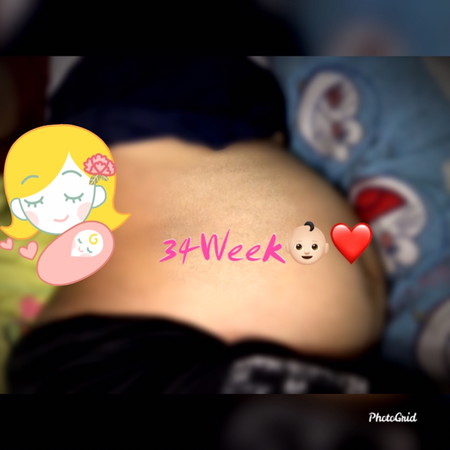 โชว์ท้อง