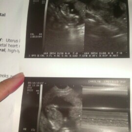 Baby