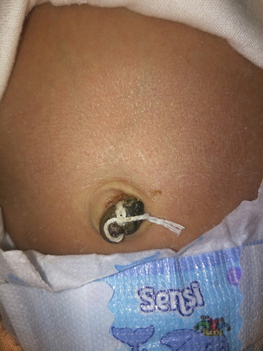 Pusar bayi