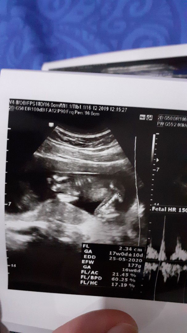 air ketuban yang sedikit.