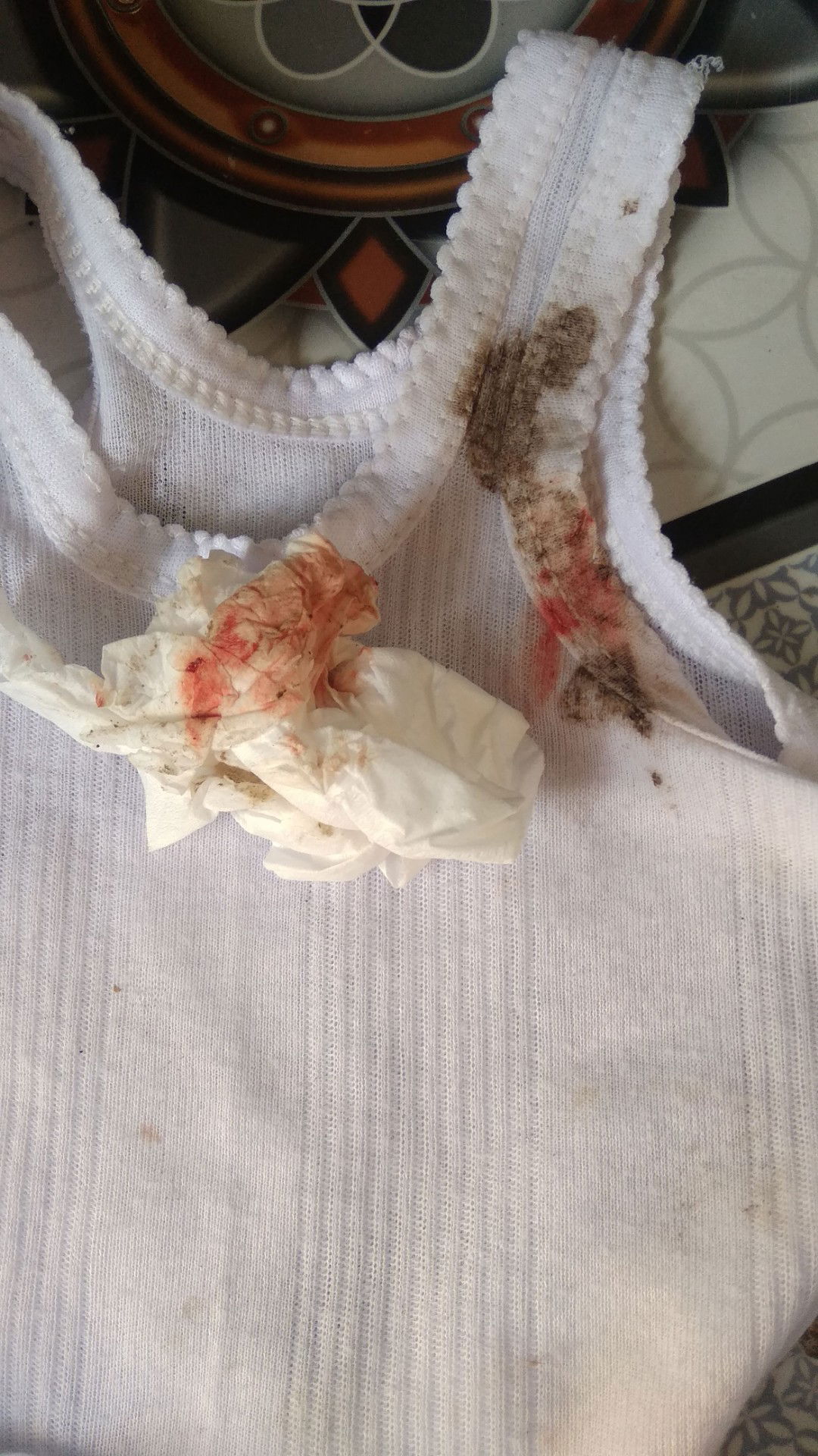 gumoh keluar bercak darah