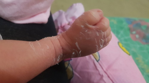 is this normal?