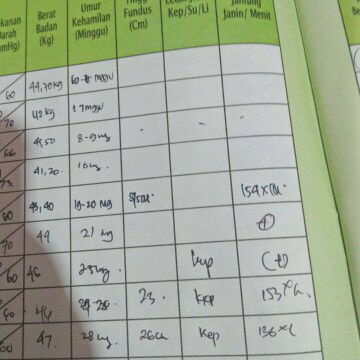 detak jantung janin nurun2 usia 28mingu