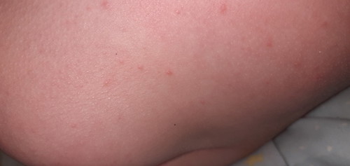 เป็นแบบนี้ทำไงถึงจะหาย