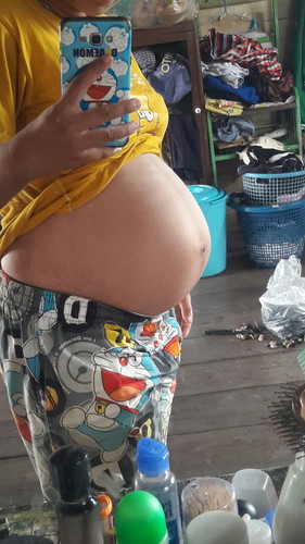 ท้อง